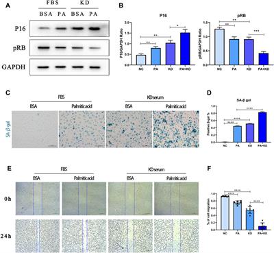 Palmitic Acid, A Critical Metabolite, Aggravates Cellular Senescence Through <mark class="highlighted">Reactive Oxygen Species Generation</mark> in Kawasaki Disease